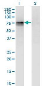 CBFA2T2 Monoclonal Antibody (3A2)