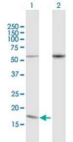 PDCD5 Polyclonal Antibody, MaxPab™