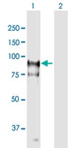 HGS Antibody in Western Blot (WB)