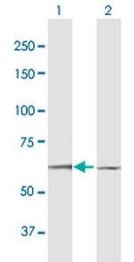 DYRK1B Antibody in Western Blot (WB)