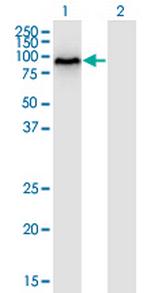 DYRK1B Monoclonal Antibody (2E8)