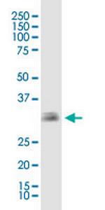 EBAG9 Monoclonal Antibody (4A10)