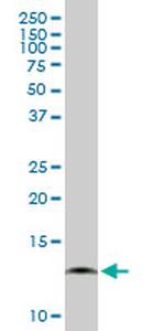 COX7A2L Antibody in Western Blot (WB)