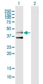 HTR3B Polyclonal Antibody, MaxPab™