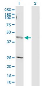 AP4M1 Antibody in Western Blot (WB)