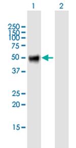 OSMR Polyclonal Antibody, MaxPab™