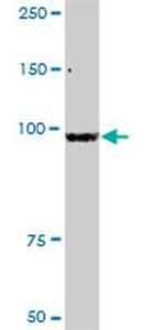 ZBED1 Antibody in Western Blot (WB)