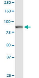 DCAMKL1 Antibody in Western Blot (WB)