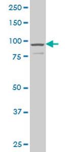 DCAMKL1 Antibody in Western Blot (WB)