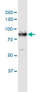 DCAMKL1 Antibody in Western Blot (WB)