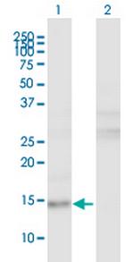 LRRFIP1 Polyclonal Antibody, MaxPab™