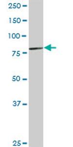 LRRFIP1 Antibody in Western Blot (WB)