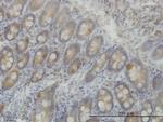 LRRFIP1 Antibody in Immunohistochemistry (Paraffin) (IHC (P))