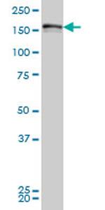 LRRFIP1 Antibody in Western Blot (WB)