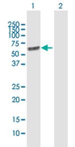 LGI1 Polyclonal Antibody, MaxPab™