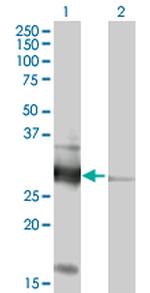 VAPB Polyclonal Antibody, MaxPab™