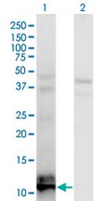 TIAF1 Monoclonal Antibody (3B9)