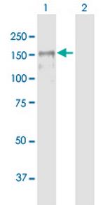 MAGI1 Polyclonal Antibody, MaxPab™