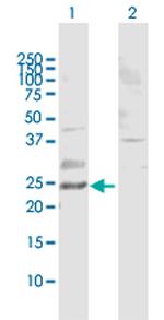 RAB11B Polyclonal Antibody, MaxPab™