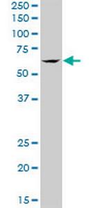 TBRG4 Antibody in Western Blot (WB)