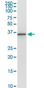 PNMA1 Antibody in Western Blot (WB)