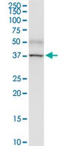 PNMA1 Antibody in Western Blot (WB)