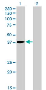 PNMA1 Antibody in Western Blot (WB)