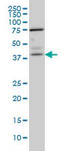 PNMA1 Monoclonal Antibody (4G6)