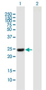 NOG Polyclonal Antibody, MaxPab™