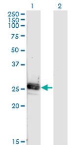 NOG Monoclonal Antibody (4A1)