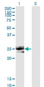 NOG Monoclonal Antibody (2C10)
