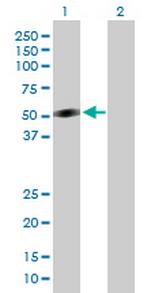 CRLF1 Antibody in Western Blot (WB)