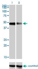 CRLF1 Monoclonal Antibody (4F4)