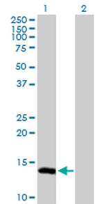 UBE2L6 Polyclonal Antibody, MaxPab™