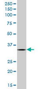 SCYE1 Monoclonal Antibody (3H5)
