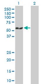PDLIM7 Polyclonal Antibody, MaxPab™