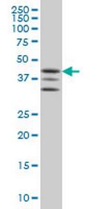 MAPKAPK2 Monoclonal Antibody (2B3)