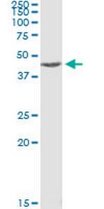 MAPKAPK2 Monoclonal Antibody (1F9)
