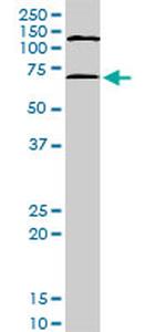 MAPKAPK2 Antibody in Western Blot (WB)