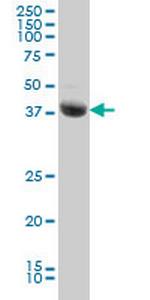 STK17B Monoclonal Antibody (2C3)