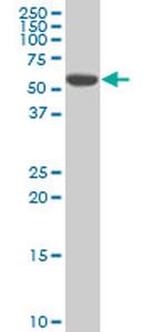 STK17A Antibody in Western Blot (WB)