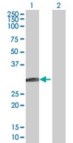 BCL7B Polyclonal Antibody, MaxPab™