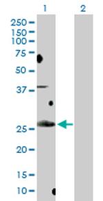 BCL7B Polyclonal Antibody, MaxPab™