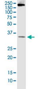 BCL7B Monoclonal Antibody (6D2)