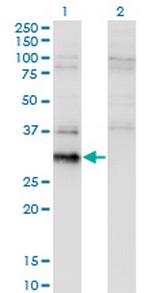BCL7B Monoclonal Antibody (4G1)