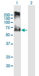 ACCN3 Polyclonal Antibody, MaxPab™