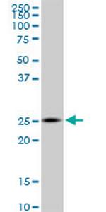 ZNHIT3 Monoclonal Antibody (2F8)