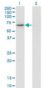 GTF3C5 Monoclonal Antibody (3F10)