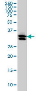 TXNL1 Monoclonal Antibody (1A10)
