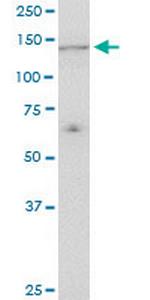 UBE4A Monoclonal Antibody (1G8)